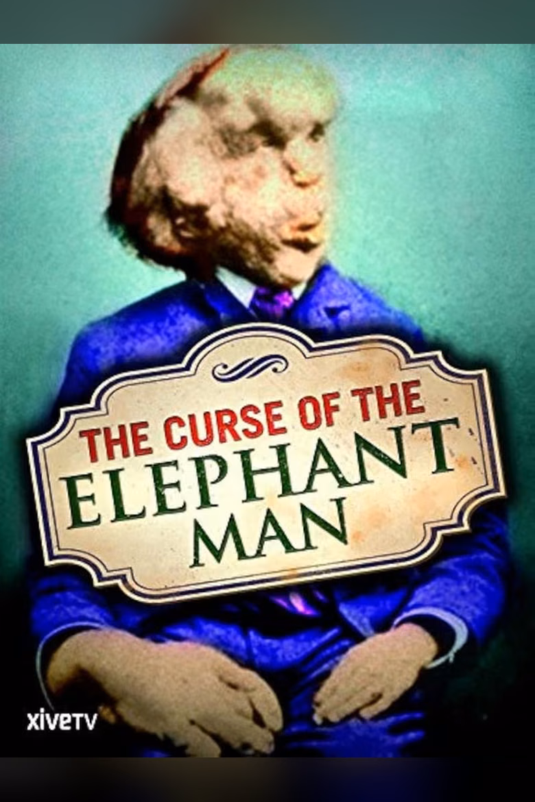 The Curse of the Elephant Man